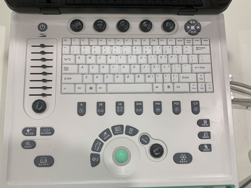 CS129 4D Black and White Ultrasound Machine - Dynamic Full-Digital Diagnostic System (4)