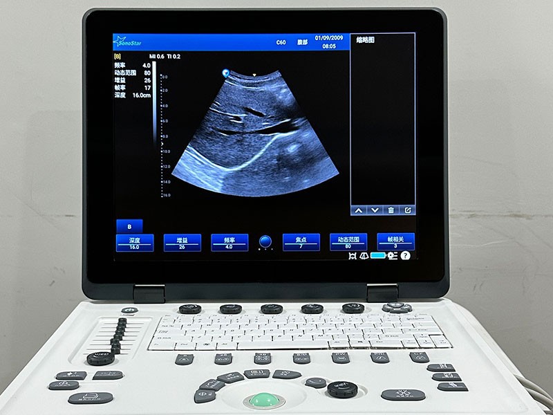 CS129 4D Black and White Ultrasound Machine - Dynamic Full-Digital Diagnostic System (2)