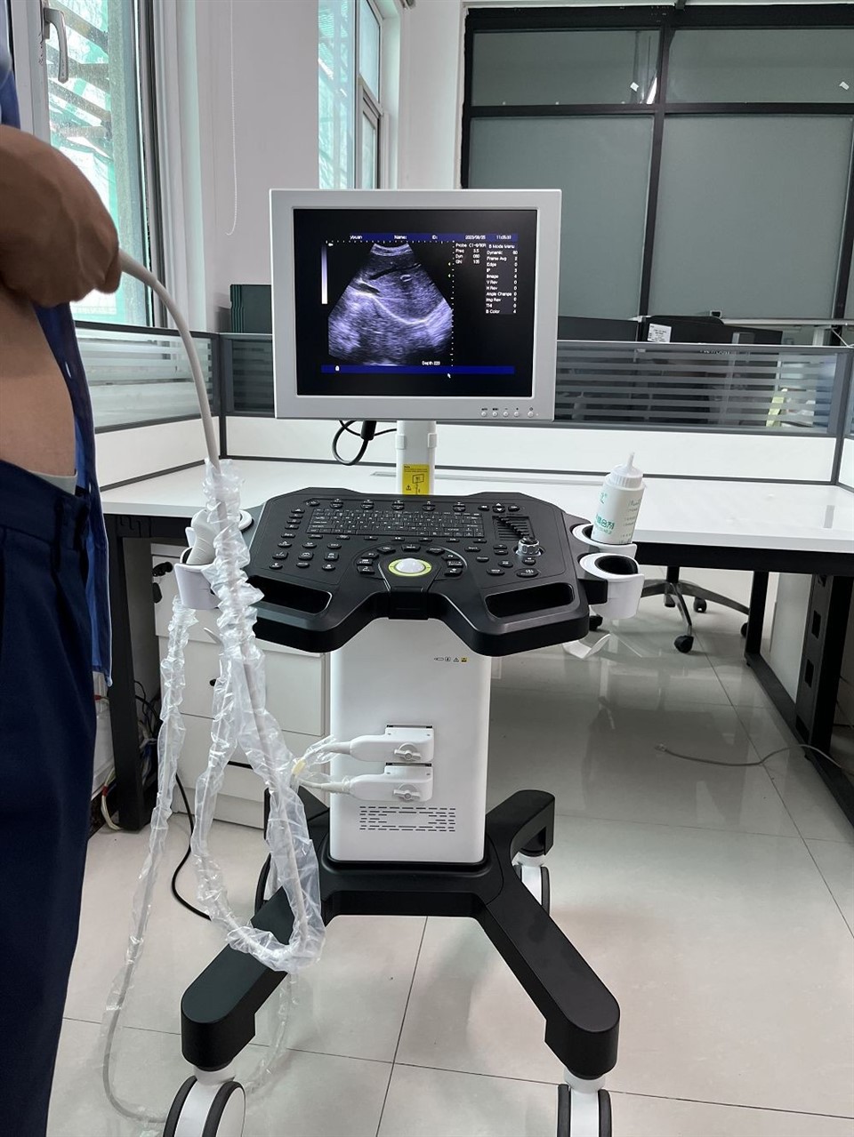 CS009 Handheld Black and White Ultrasound Machine - Trolley-Mounted Full-Digital Diagnostic System (2)(001)